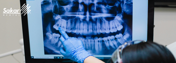 Sonrisa digital: tu diseño antes del tratamiento